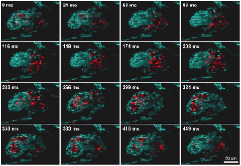 3-D reconstruction of a beating zebra fish heart imaged at a 60-Hz volume rate with a light-sheet microscope equipped with an ETL for fast Z-scanning (ETL-SPIM).