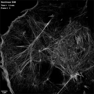 Cytoskeleton