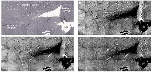 H&E-stained image of a mouse brain section on IR reflective slide, with selected regions labeled: hypothalamus, thalamus, and dentate gyrus.