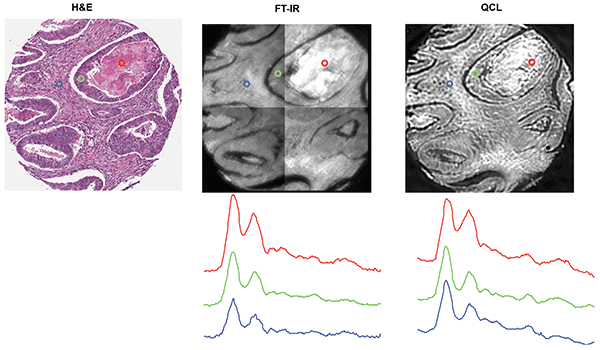 H&E-stained section of human colon tissue, and FTIR (with 16 coadditions) and Spero microscope transmission images of a 4-µm thick serial section of the same sample on barium fluoride. FTIR image shown at 1650 cm-1, Spero microscope image shown at 1652 cm-1.