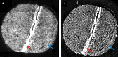 Transmission FTIR image of a 4-µm thick section from a human liver tissue microarray on barium fluoride at 1650 cm-1.