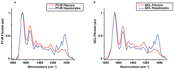 Averaged spectra for regions of interest corresponding to the hepatocytes and the fibrotic area on the FTIR image in Figure 3a.