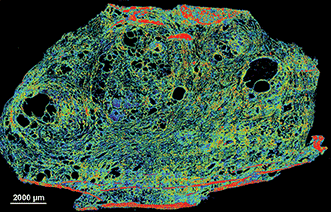 Transflectance scan of a 5-µm frozen human prostate tissue section on Kevley low-emissivity substrate captured with the Spero microscope.