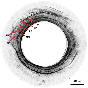 Endoscopic OCT imaging of a guinea pig esophagus in vivo (SC: Stratum Corneum; EP: Epithelium; LP: Lamina Propria; MM: Muscularis Mucosae; SM: Submucosae; MP: Muscularis Propria). 