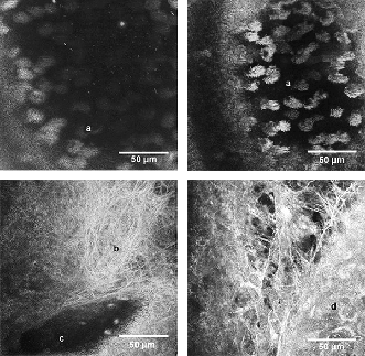 En-face images of mouse trachea at different depths showing cilia (a), fibrous structure (b), vessel (c) and single cell (d).