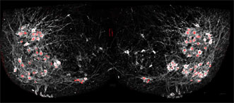Adventurer horsepower Alienation Spinal Neuron Connections Probed with Fluorescence Microscopy | BioScan |  Dec 2015 | BioPhotonics