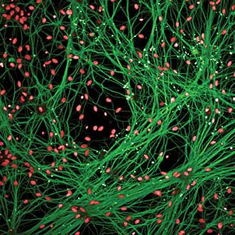 Confocal image of neurons from mouse motor cortex.