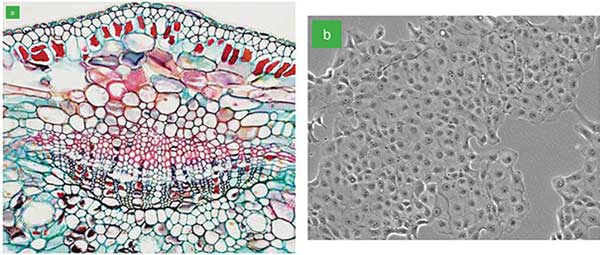 Bright-field microscope images depicting stained slides (a) and a phase contrast image of cells in a migration chamber (b). 