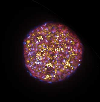 Can Confocal Microscopes Compete with the Emergence of Superresolution?