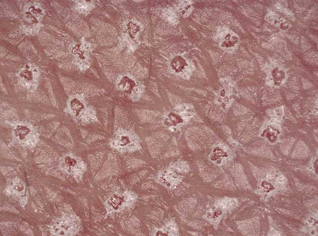 Medical Lasers Cut and Heal