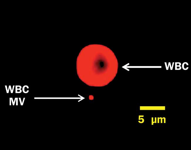  A white blood cell (WBC) and a microvesicle (MV), labeled for surface protein CD45 and captured on a Millipore ImageStreamX imaging flow cytometer under 640-nm excitation.