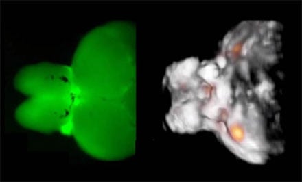 Novel Optoacoustic Technique Reveals Deep Neural Activity