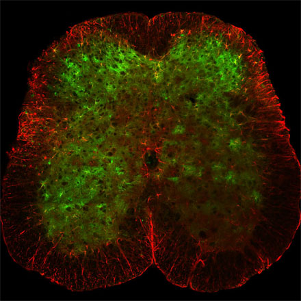 Salk Institute scientists have observed the involvement of cells called astrocytes in spinal sensory processing. 