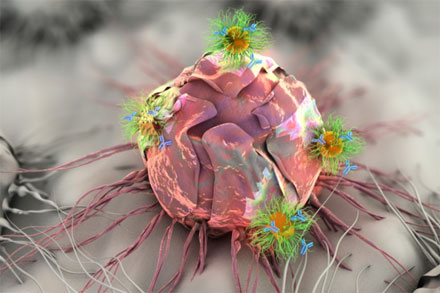 Device Combines Phototherapy, Drug and Gene Therapy to Treat Cancer