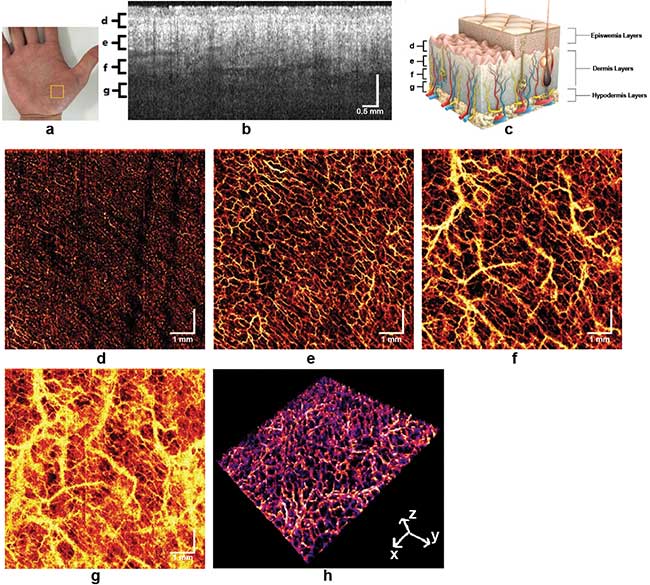 Swept Source OCT Takes Optical Medical Imaging to the Next Level