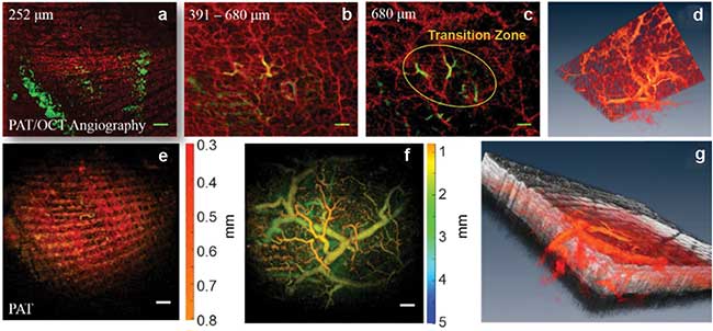 Skin angiography, with additional information and comparison to photoacoustic tomography (PAT), showing different depth ranges and a 3D visualization.