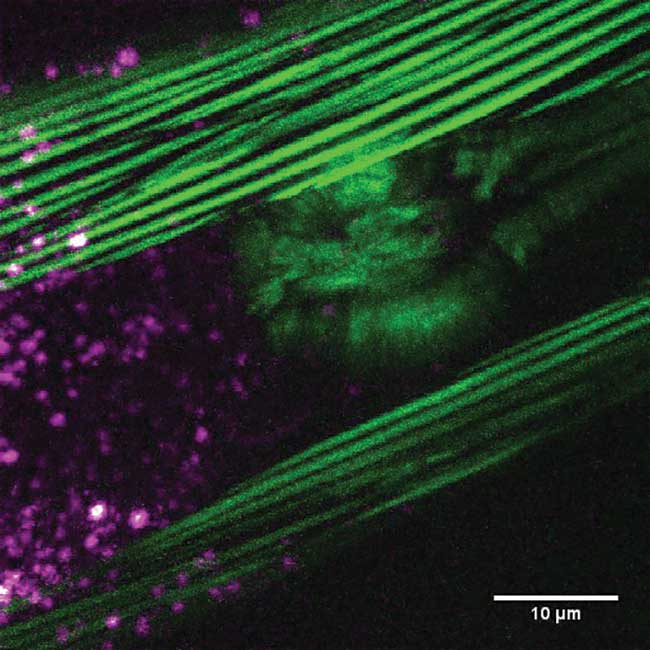 Projection of the three-dimensional multimodal image of the nematode Ceanorhabditis elegans. 