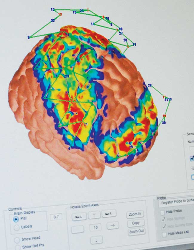 Brainscape software enables localization of cortical functional activation from NIRS data.