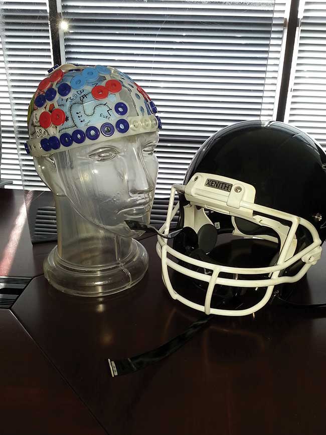 NIRS has been used to study concussions.
