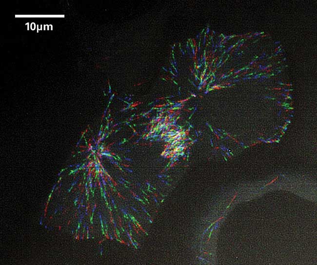 Image of eGFP-EB1 in live cells, collected using the iSIM microscope. 