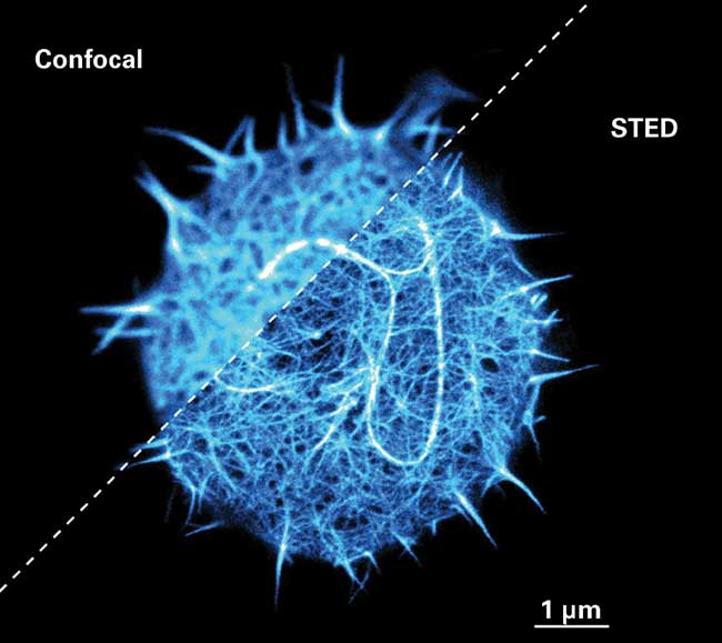 Confocal and STED microscopy image of F-actin (Lifeact-Citrine) in a live Jurkat T-cell. This data was taken by Mathias Clausen and Marco Fritzsche. 