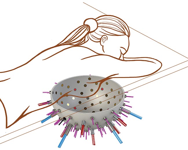 An artist’s rendition of the PAMMOTH device that uses a hemispherical bowl lined with optical fibers and ultrasound detectors for the early detection of breast cancer. 