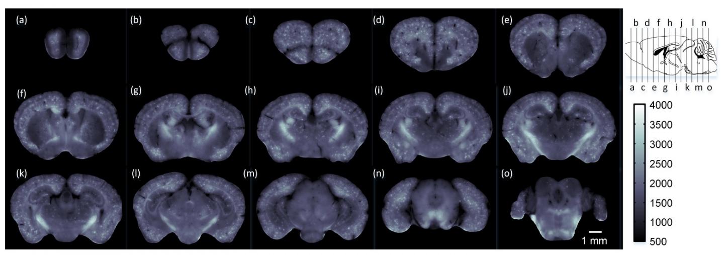 Label-Free Imaging Maps Whole-Brain Changes in Alzheimer Mouse Model