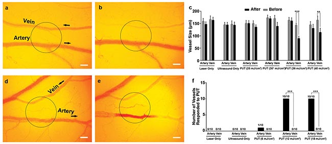Photomediated Ultrasound Therapy Offers Precision Targeting of Microvessels