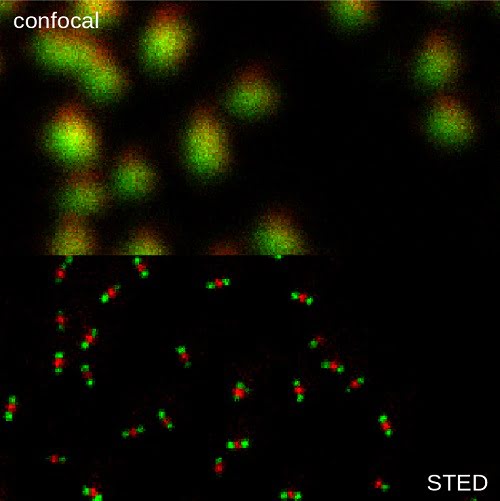 Microscopy images demonstrating the resolution difference between confocal and STED imaging. 