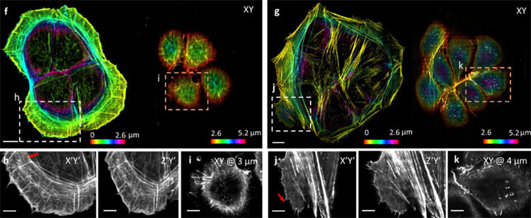 NIH Team Improves 3D Imaging Efficiency, Speed and Resolution