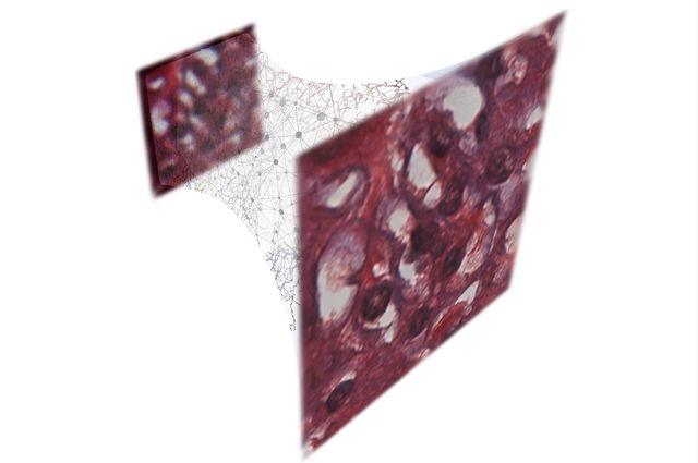 Holographic Technique Uses Deep Learning to Increase Accuracy, Improve Microscopy