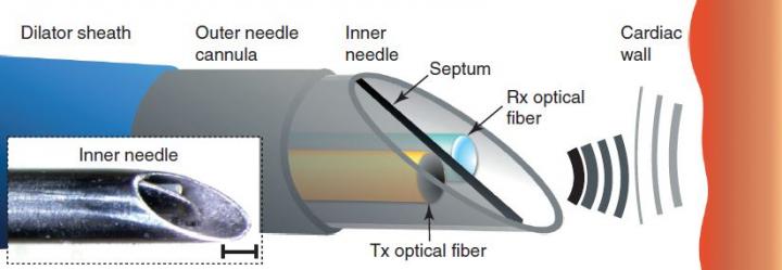 All-optical ultrasound imaging needle for heart surgery, University College London.
