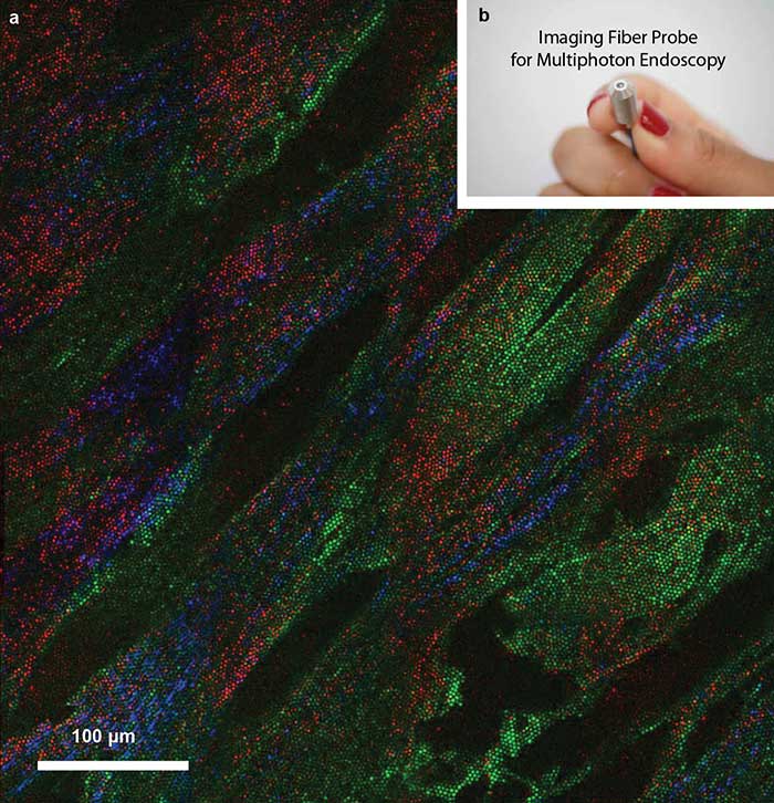 Multimodal image acquired by a multiphoton imaging-fiber probe of human skin composed of keratin and lipids in the upper primary layer (epidermis), and collagen and elastin fibers in the extracellular matrix 