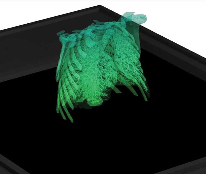 3D video hologram of a ribcage.