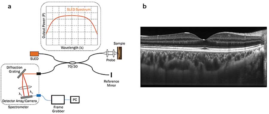  Generic setup of a spectral domain (SD)-OCT system with a reflective Michelson interferometer (a), 2D OCT cross section (B-scan) of a human retina, recorded with a 1070-nm broadband SLED source and a high-resolution spectrometer with an InGaAs camera (b). 