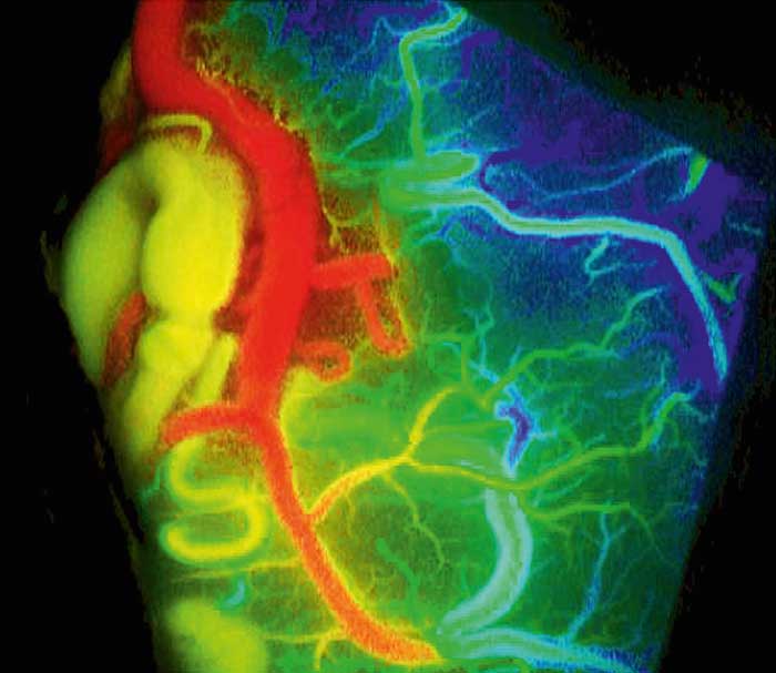 FLOW 800 from Zeiss generates overview maps and diagrams and permits an interpretation of the fluorescence videos and an analysis of the blood flow dynamics through comparative views. T