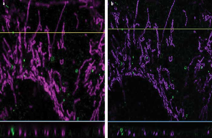 Comparison of autophagy captured using confocal imaging (a) and the Olympus OSR superresolution algorithm with 3D deconvolution (b), demonstrating enhanced resolution.