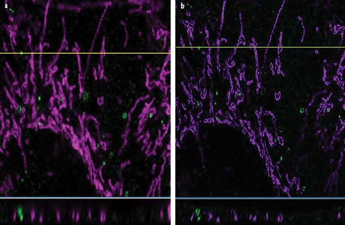 Comparison of autophagy captured using confocal imaging (a) and the Olympus OSR superresolution algorithm with 3D deconvolution (b), demonstrating enhanced resolution. 