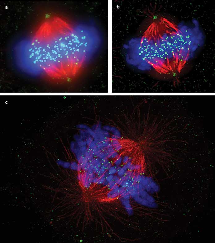 Visualization of somatic cell mitotic metaphase of the mitotic spindle, comparing widefield (a), deconvolution only (b) and superresolution (c). 