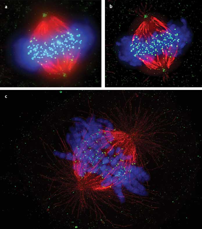 Visualization of somatic cell mitotic metaphase of the mitotic spindle, comparing widefield (a), deconvolution only (b) and superresolution (c).