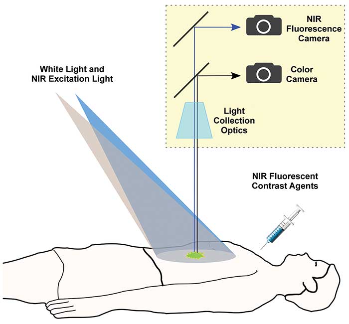 With fluorescence image-guided surgery,