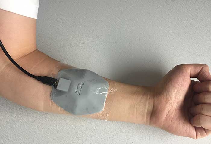  A new diffuse optical wearable probe developed at Boston University is designed to track tumor metabolism and changes in the blood during breast cancer treatment.