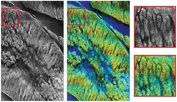 FLIM Delivers Intracellular Images Based on Differences