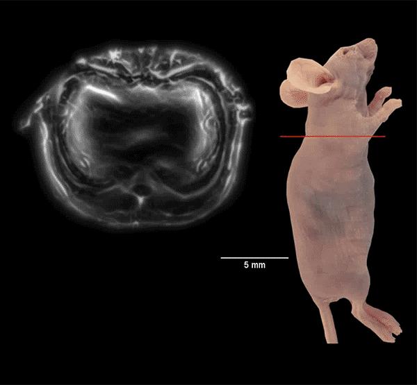 SIP-PACT photoacoustic imaging of small animals, Duke University.