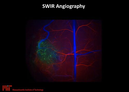 From high-speed intravital imaging for angiography in a brain tumor model to high resolution and high-speed SWIR intravital imaging to generate flow maps of microvascular networks using QD composite particles.