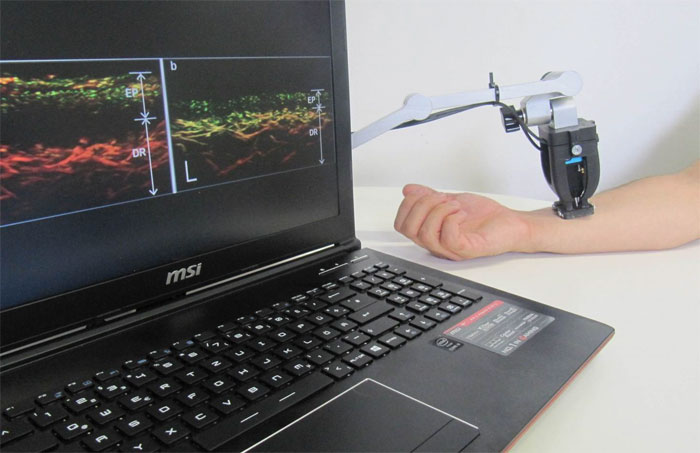 Handheld Optoacoustics Device Sees Under Skin