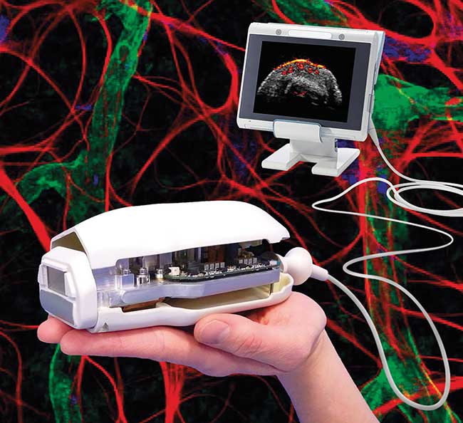 Artist’s impression of a handheld photoacoustic imaging (PAI) medical system integrating a four-wavelength laser diode source. 