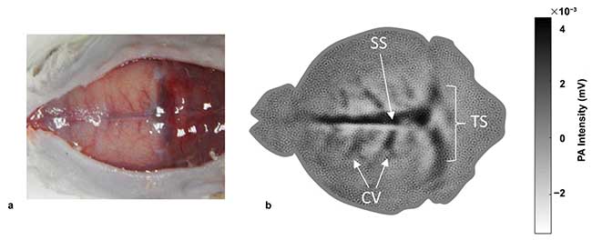 Noninvasive, diode-based photoacoustic tomography images of the vasculature in a 93-g female rat brain.