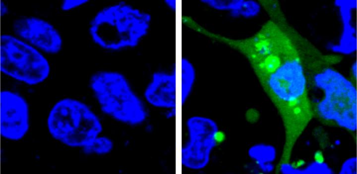 Fluorescent Sensor Detects Drug-Induced Protein Stress in Cells