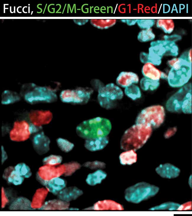 Silicone Immersion Objectives Answer the Call for Higher Resolution